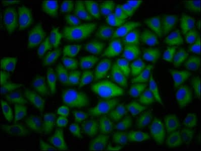 Dysferlin Antibody (aa105-278)
