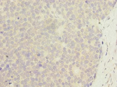 ZNF688 Antibody