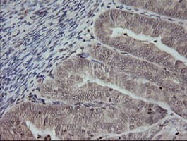MAP2K3 / MEK3 / MKK3 Antibody (clone OTI5C7, Carrier-free)
