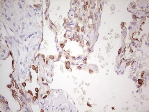 ABCB1 / MDR1 / P Glycoprotein Antibody (aa995-1280, clone OTI10H3)