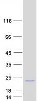Human SLC51B / OSTBETA Protein (Recombinant Myc-DDK (Flag))