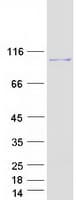Human COG5 Protein (Recombinant Myc-DDK (Flag))