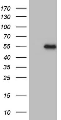 MSTN / GDF8 / Myostatin Antibody (aa24-266, clone OTI4F9)
