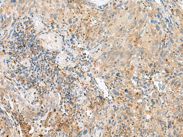 TNRC5 / CNPY3 Antibody