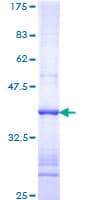 Human IFNK Protein (Recombinant GST, N-terminus)