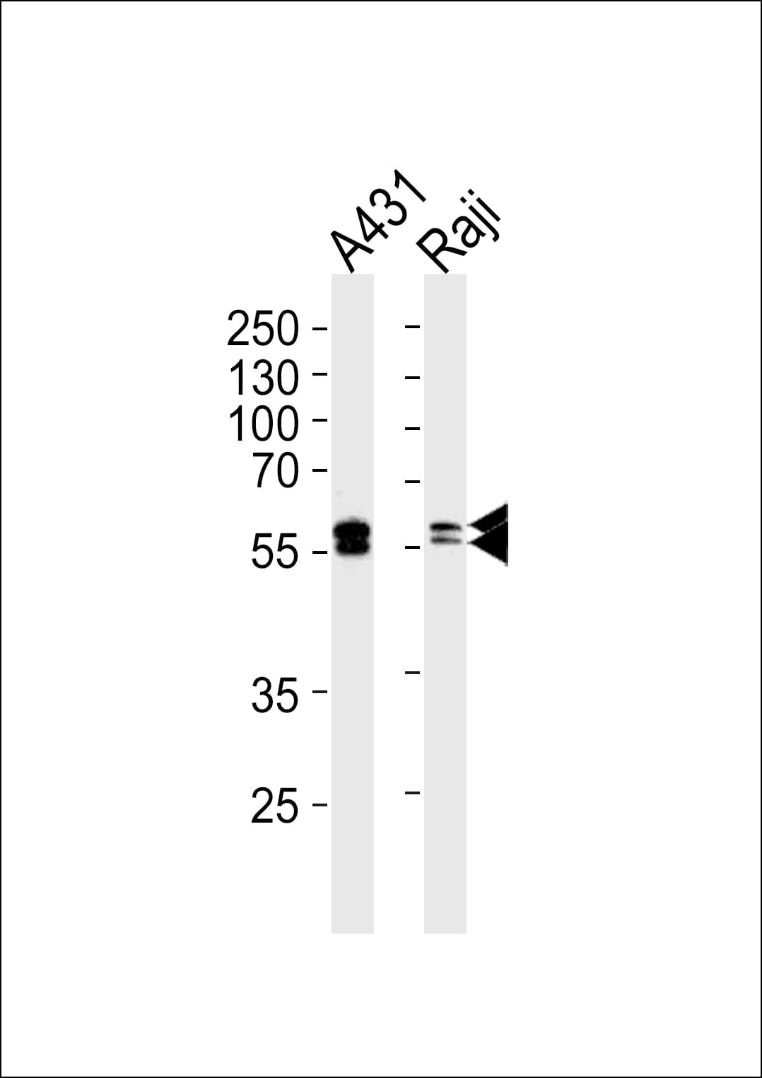 LYN Antibody (aa1-210, clone 1174CT22.3.1.1)