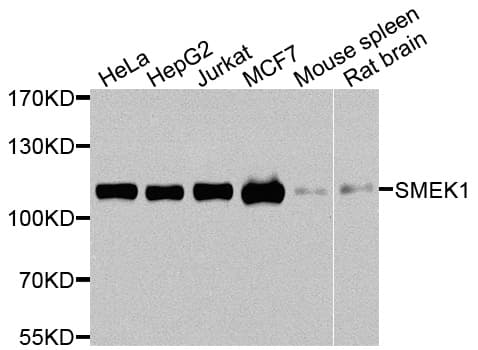 Polyclonal Rabbit anti-Human SMEK1 Antibody (IHC, WB)