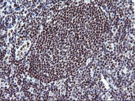 Monoclonal Mouse anti-Human KIF25 Antibody (clone OTI2D6, IHC, WB)