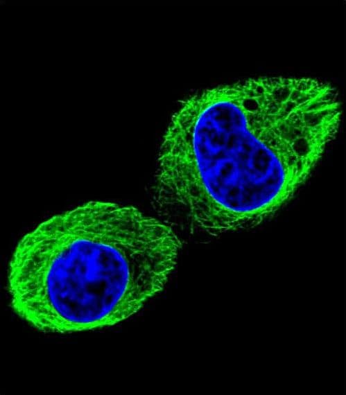TUBB2B / Tubulin Beta 2B Antibody (aa12-39)