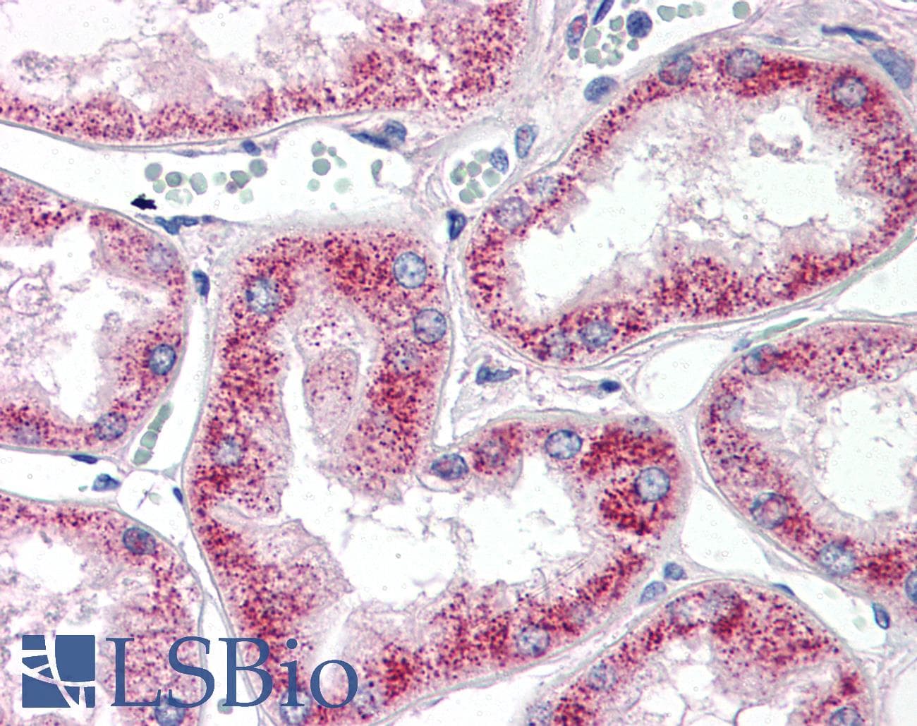 PathPlus™ MMP2 Antibody (aa468-483)
