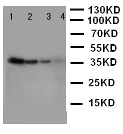 Polyclonal Rabbit anti-Human LAT2 / NTAL Antibody (aa34-48, WB)