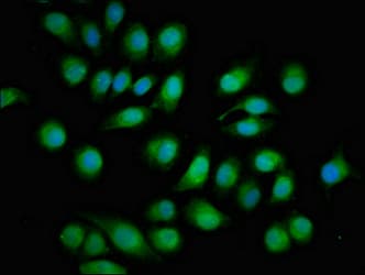 TOB1 / TOB Antibody