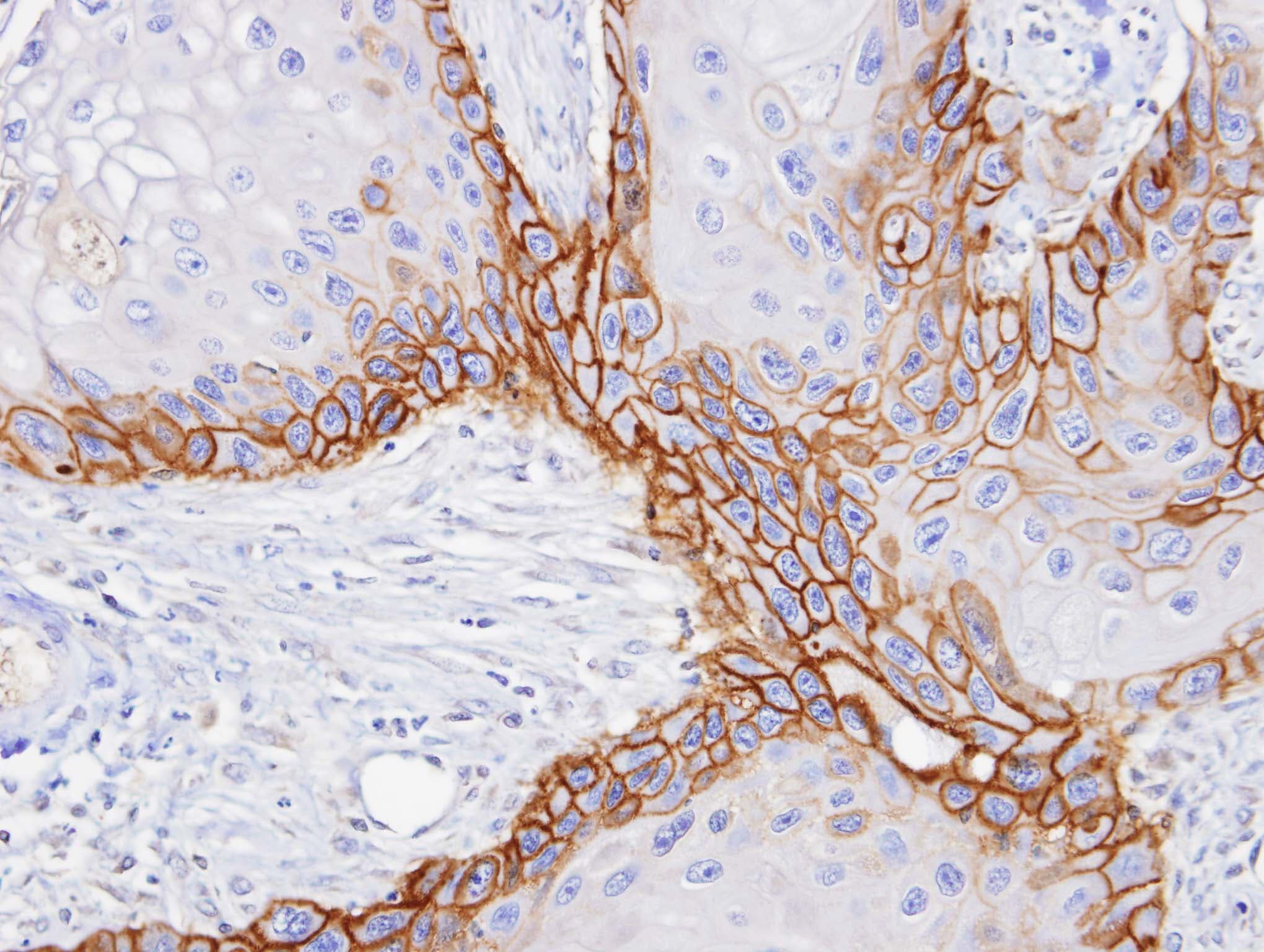 IHC-plus™ SLC3A2 / CD98 Heavy Chain Antibody (aa89-433)