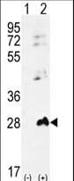Polyclonal Rabbit anti-Human AK1 / Adenylate Kinase 1 Antibody (aa30-59, WB)