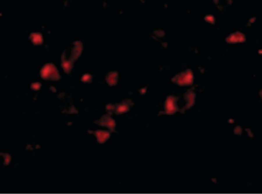 JPH4 Antibody