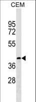 CCDC113 Antibody (aa291-320)