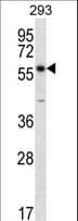 PNPLA1 Antibody (aa1-30)