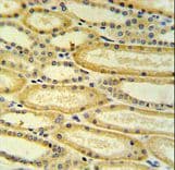 HSD17B11 Antibody (aa81-110)