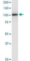 PLD2 / Phospholipase D2 Antibody (clone 1C5)