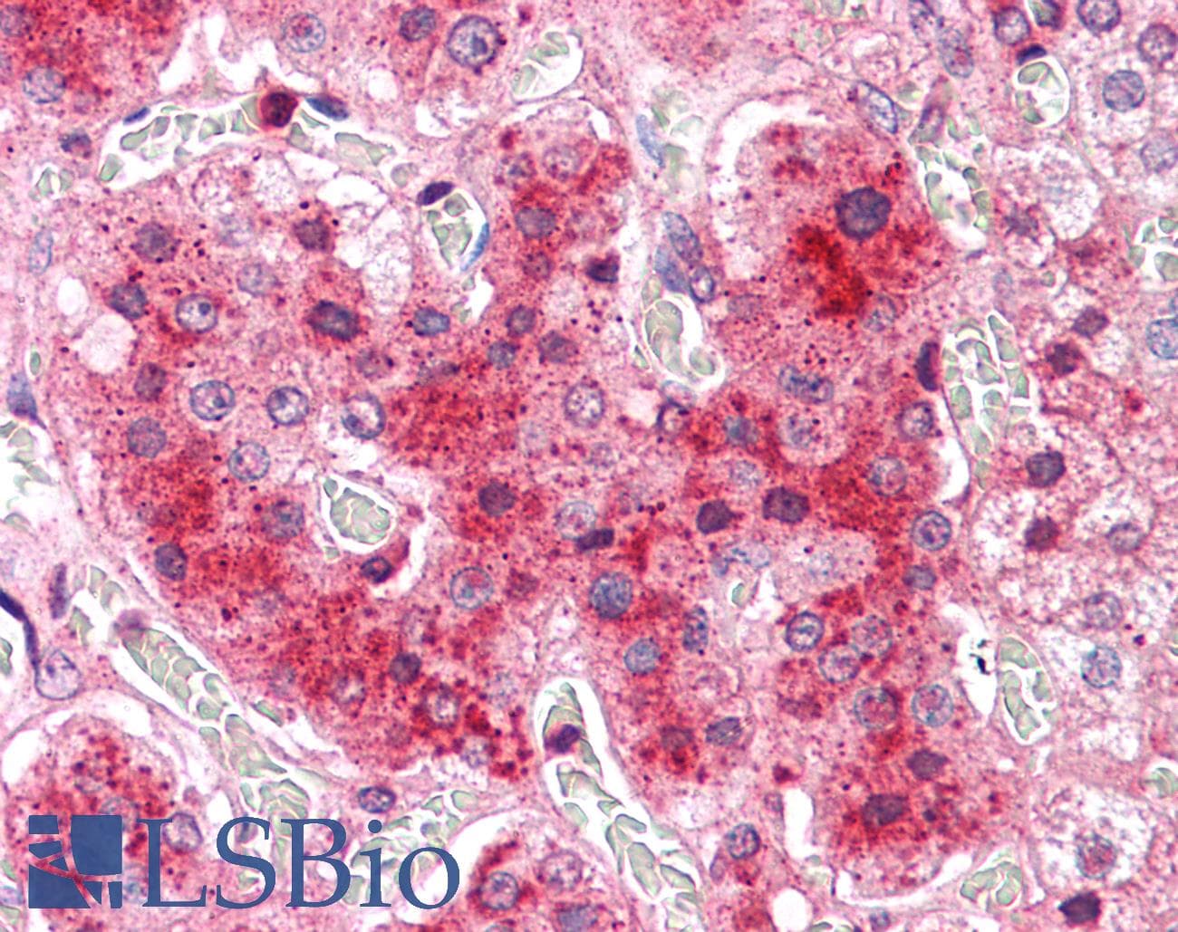 IHC-plus™ COMT Antibody (N-Terminus)