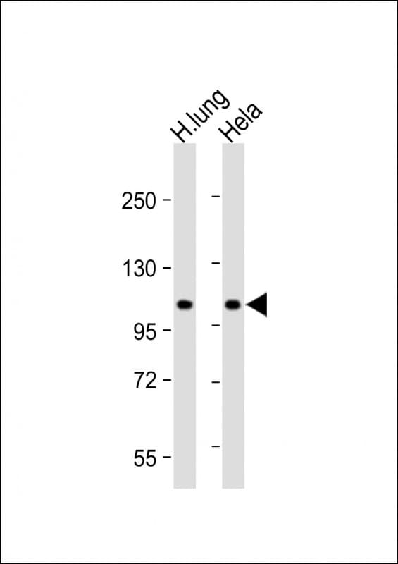 Polyclonal Rabbit anti-Human NAT10 Antibody (N-Terminus, WB)