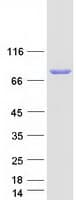 Human ACSL6 Protein (Recombinant Myc-DDK (Flag))