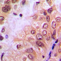 Polyclonal Rabbit anti-Human ABL1 / c-ABL Antibody (N-Terminus, IHC, WB)