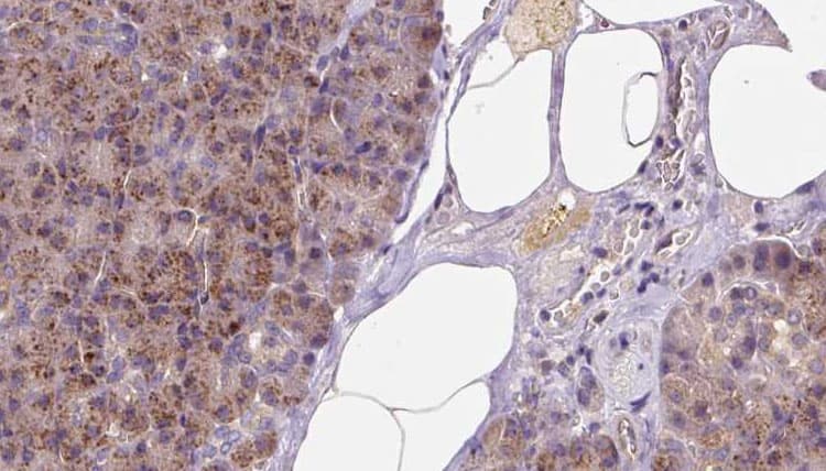 Polyclonal Rabbit anti-Human GSTM4-4 / GSTM4 Antibody (IHC, IF, WB)