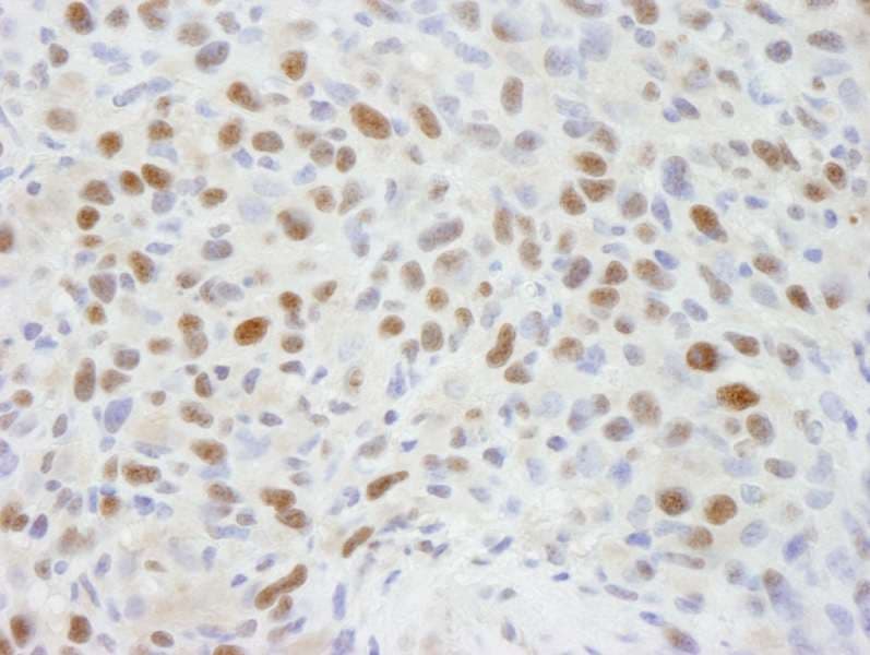RBBP7 / RbAp46 Antibody (aa375-C-term)