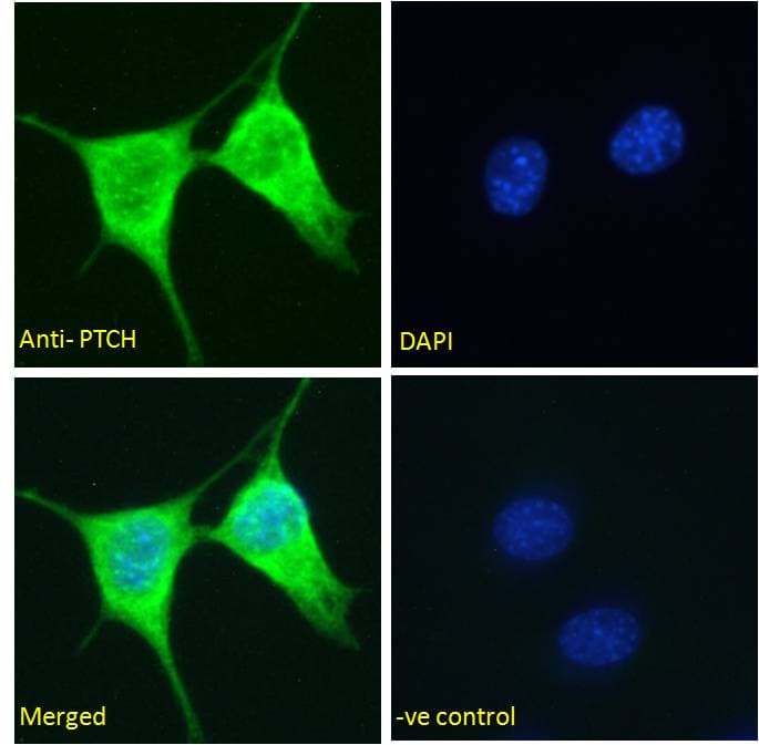 IHC-plus™ PTCH1 / Patched 1 Antibody (aa1431-1442)