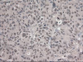 NOTCH1 Antibody (clone OTI3E12)