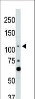 LATS2 Antibody (aa228-258)