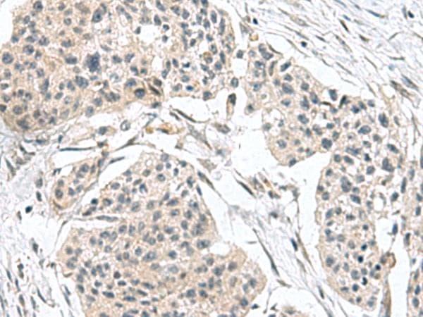 Polyclonal Rabbit anti-Human TPD52L3 Antibody (IHC)
