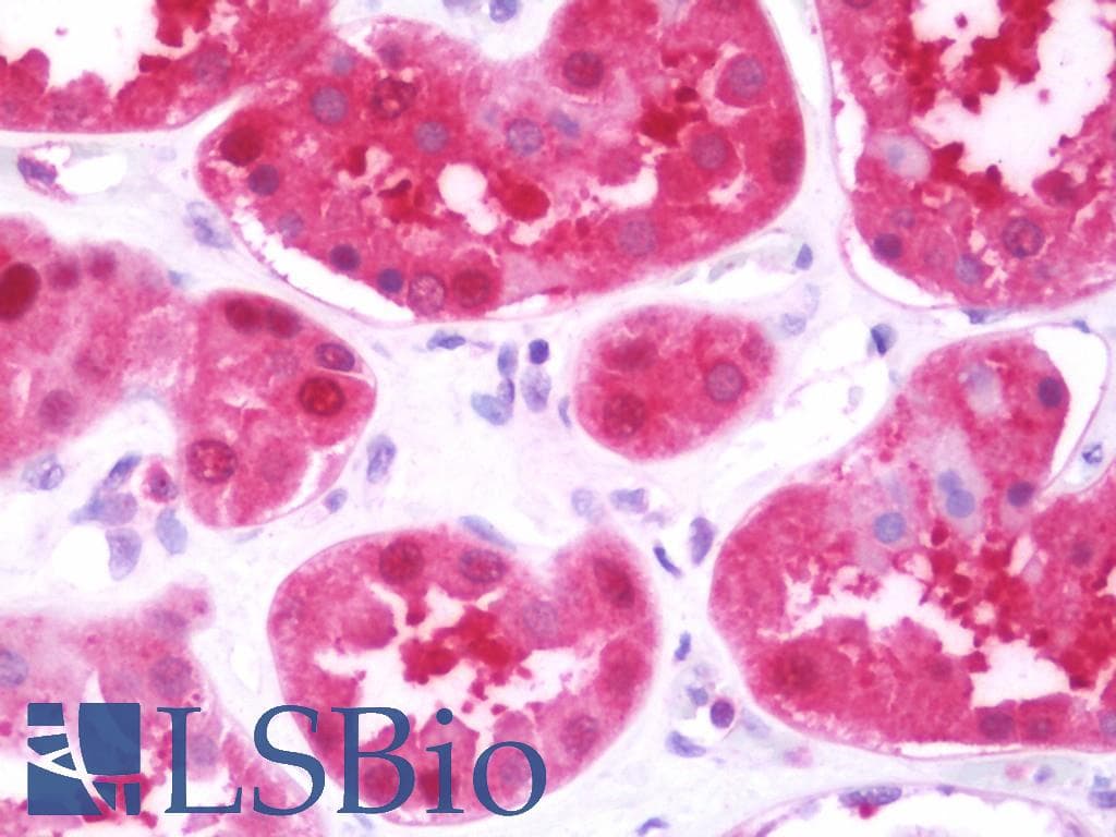IHC-plus™ Polyclonal Rabbit anti-Human CLDN14 / Claudin 14 Antibody (aa177-239, IHC, WB)