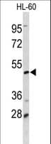 DCP2 Antibody (aa144-173)