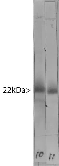 IHC-plus™ Monoclonal Mouse anti-Human VILIP / VSNL1 Antibody (clone 2D11, IHC, IF, WB)