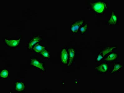 DAPK2 / DAP Kinase 2 Antibody (aa222-370)
