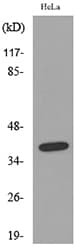 Polyclonal Rabbit anti-Human KIR2DL3 + KIR2DS2 Antibody (WB)