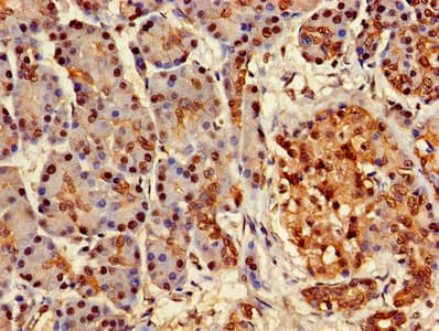 ATXN3 / JOS Antibody (aa1-288)