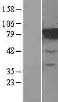 MTRR Protein (Over-Expression Lysate Myc-DDK (Flag))