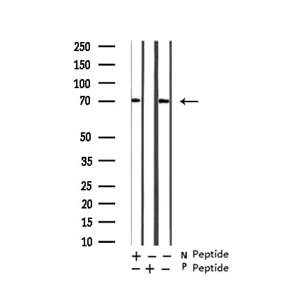 RICK / RIP2 Antibody (phospho-Ser176)