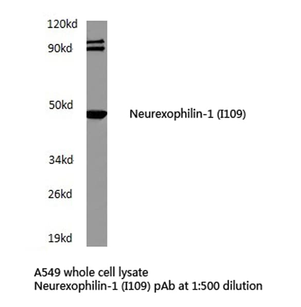 Polyclonal Rabbit anti-Human NXPH1 Antibody (Ile109, IHC, WB)