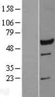 LRRC6 Protein (Over-Expression Lysate Myc-DDK (Flag))