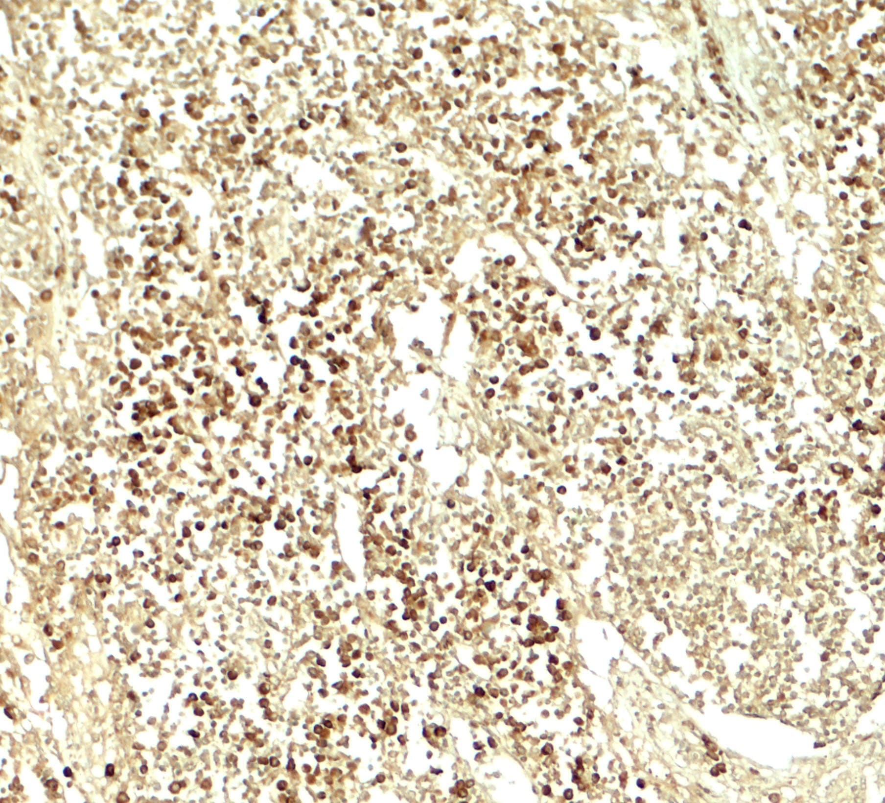 Polyclonal Rabbit anti-Human E2F3 Antibody (IHC, IF, WB)
