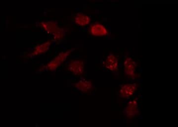 Polyclonal Rabbit anti-Human HAPLN1 Antibody (IHC, IF, WB)