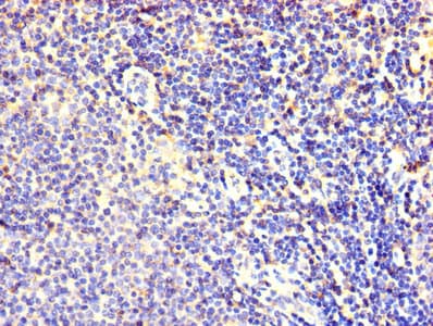 Polyclonal Rabbit anti-Human FBXL18 Antibody (WB)
