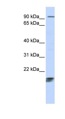 ICT1 / DS1 Antibody (aa108-157)