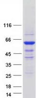 Human ICA69 / ICA1 Protein (Recombinant Myc-DDK (Flag))