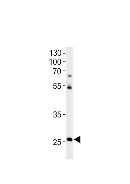 Polyclonal Rabbit anti-Zebrafish HOXC4 Antibody (aa240-267, WB)