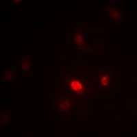 Polyclonal Rabbit anti-Human ZNF435 / ZSCAN16 Antibody (IHC, IF, WB)
